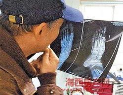 男明星脚骨折后,男明星脚骨折后励志康复之路